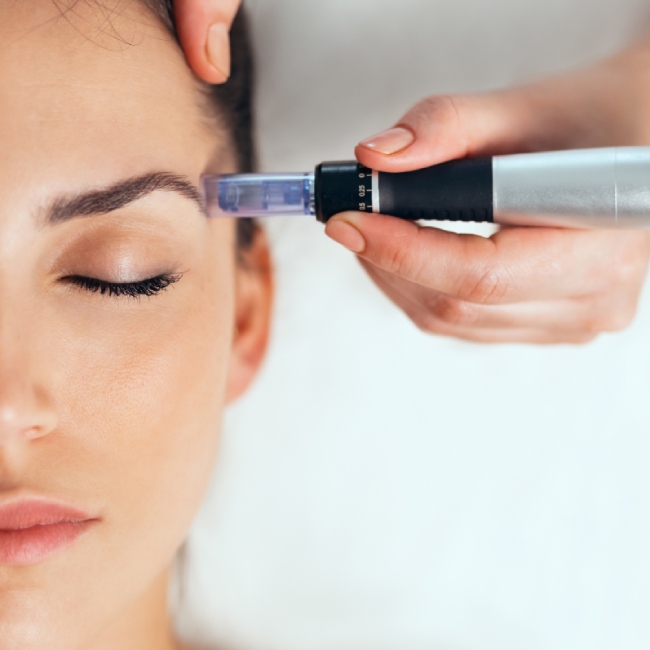 SkinPen for Microneedling Renton WA