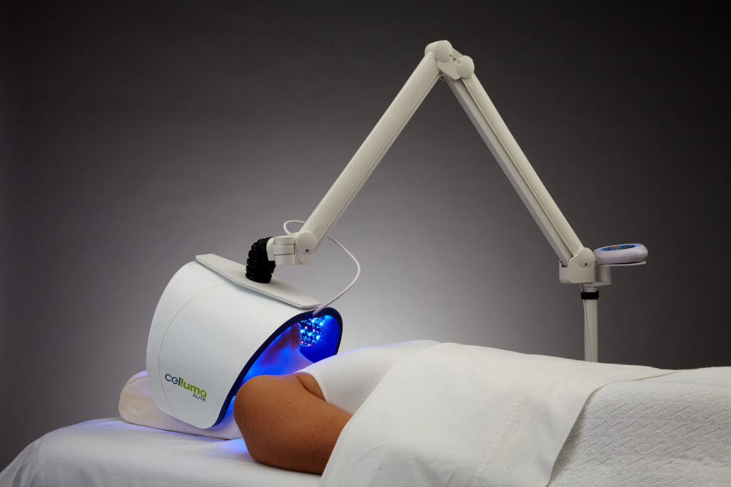 Celluma blue light LED therapy for teen acne