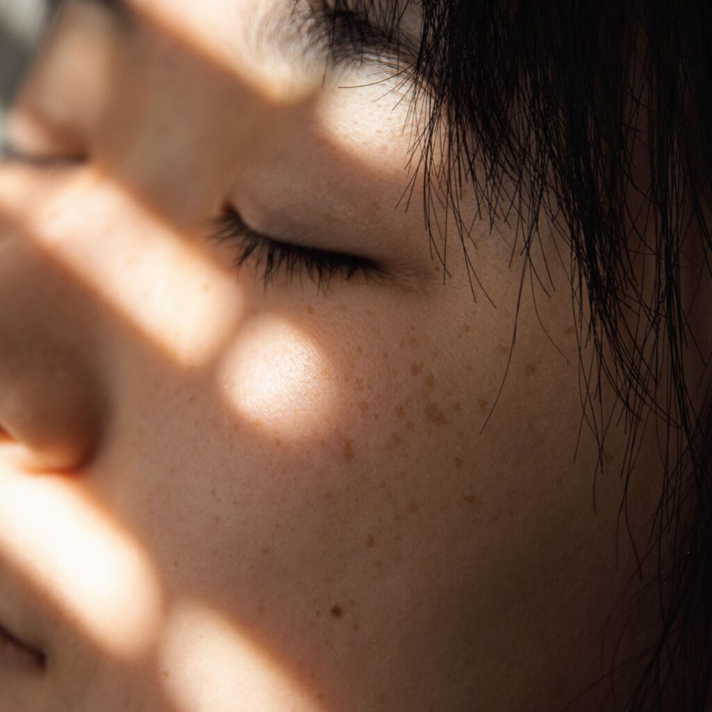 Treat Existing Pigmentation